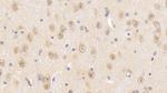 SNUPN Antibody in Immunohistochemistry (Paraffin) (IHC (P))