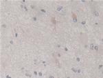 SKP1 Antibody in Immunohistochemistry (Paraffin) (IHC (P))