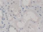SKP1 Antibody in Immunohistochemistry (Paraffin) (IHC (P))
