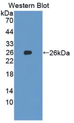 SKP1 Antibody in Western Blot (WB)