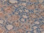 Syk Antibody in Immunohistochemistry (Paraffin) (IHC (P))