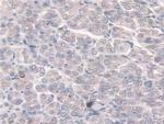 SULF2 Antibody in Immunohistochemistry (Paraffin) (IHC (P))