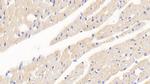 SOD2 Antibody in Immunohistochemistry (Paraffin) (IHC (P))