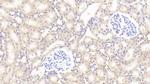 SOD2 Antibody in Immunohistochemistry (Paraffin) (IHC (P))