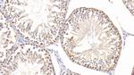 SOD2 Antibody in Immunohistochemistry (Paraffin) (IHC (P))