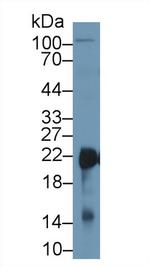 SOD2 Antibody in Western Blot (WB)