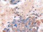 SOD2 Antibody in Immunohistochemistry (Paraffin) (IHC (P))