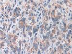 SOD2 Antibody in Immunohistochemistry (Paraffin) (IHC (P))