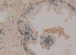 CCS Antibody in Immunohistochemistry (Paraffin) (IHC (P))