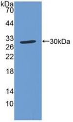 CCS Antibody in Western Blot (WB)