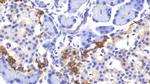 SOCS2 Antibody in Immunohistochemistry (Paraffin) (IHC (P))