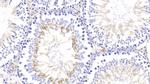 SOCS2 Antibody in Immunohistochemistry (Paraffin) (IHC (P))