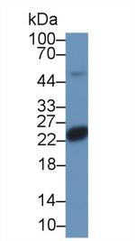 SOCS2 Antibody in Western Blot (WB)