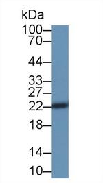 SOCS2 Antibody in Western Blot (WB)