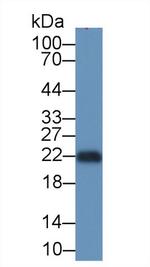 SOCS2 Antibody in Western Blot (WB)