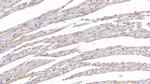 Tenascin C Antibody in Immunohistochemistry (Paraffin) (IHC (P))