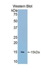 Tenascin C Antibody in Western Blot (WB)