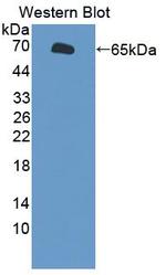 SLC26A8 Antibody in Western Blot (WB)