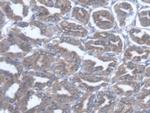 TST Antibody in Immunohistochemistry (Paraffin) (IHC (P))