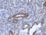 TST Antibody in Immunohistochemistry (Paraffin) (IHC (P))