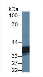 TST Antibody in Western Blot (WB)