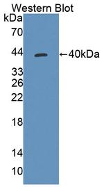 TST Antibody in Western Blot (WB)