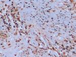 Thymidylate Synthase Antibody in Immunohistochemistry (Paraffin) (IHC (P))