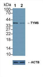 Thymidylate Synthase Antibody in Western Blot (WB)