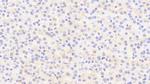 THRSP Antibody in Immunohistochemistry (Paraffin) (IHC (P))