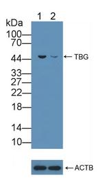 SERPINA7 Antibody in Western Blot (WB)