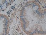 TL1A Antibody in Immunohistochemistry (Paraffin) (IHC (P))