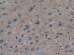 TL1A Antibody in Immunohistochemistry (Paraffin) (IHC (P))