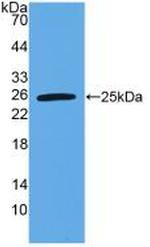 TL1A Antibody in Western Blot (WB)