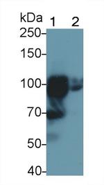 TLR5 Antibody in Western Blot (WB)