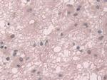 Transketolase Antibody in Immunohistochemistry (Paraffin) (IHC (P))