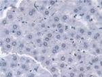 Transketolase Antibody in Immunohistochemistry (Paraffin) (IHC (P))