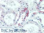 TMEM27 Antibody in Immunohistochemistry (Paraffin) (IHC (P))