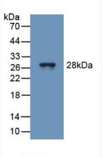 TUBD1 Antibody in Western Blot (WB)