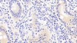 TUBD1 Antibody in Immunohistochemistry (Paraffin) (IHC (P))