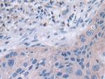 TUBD1 Antibody in Immunohistochemistry (Paraffin) (IHC (P))