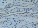 TNFR1 Antibody in Immunohistochemistry (Paraffin) (IHC (P))