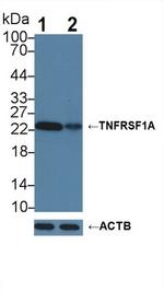 TNFR1 Antibody in Western Blot (WB)