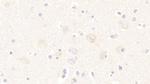 TSG Antibody in Immunohistochemistry (Paraffin) (IHC (P))