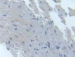 TYK2 Antibody in Immunohistochemistry (Paraffin) (IHC (P))