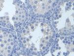 TYK2 Antibody in Immunohistochemistry (Paraffin) (IHC (P))