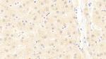 UBAP2 Antibody in Immunohistochemistry (Paraffin) (IHC (P))