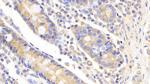 UBE2S Antibody in Immunohistochemistry (Paraffin) (IHC (P))