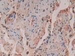 VAV3 Antibody in Immunohistochemistry (Paraffin) (IHC (P))