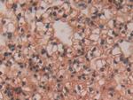 VAV3 Antibody in Immunohistochemistry (Paraffin) (IHC (P))