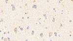 WASP Antibody in Immunohistochemistry (Paraffin) (IHC (P))